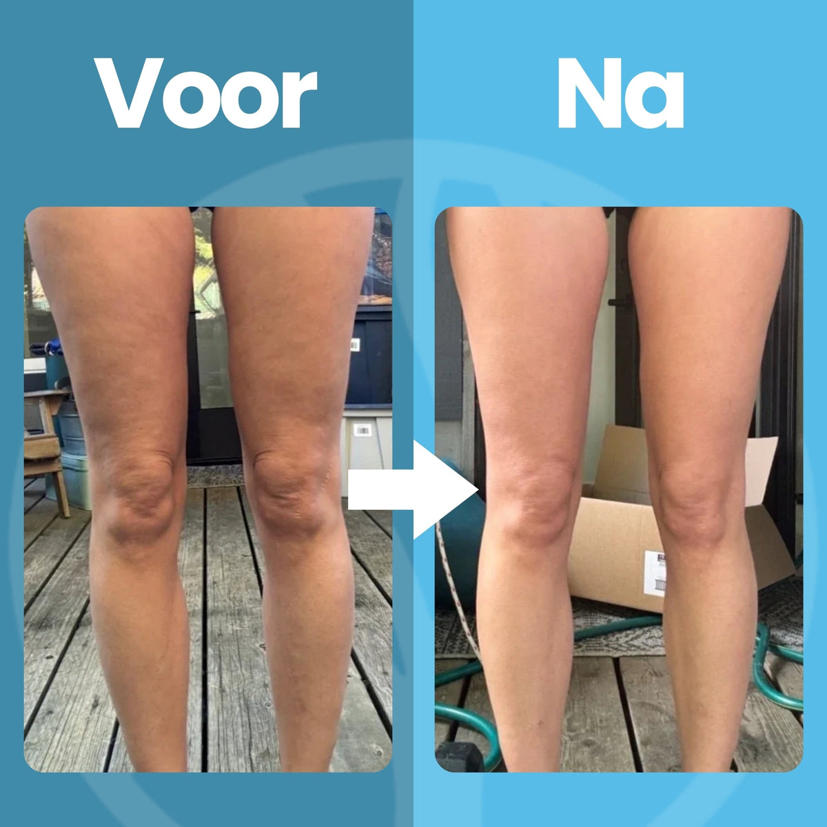 Vitalix massager för fastare hud utan smärta eller ingrepp